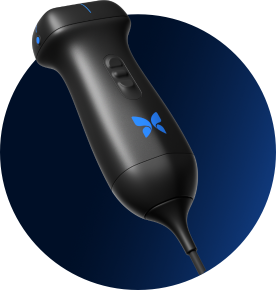 Butterfly iQ3